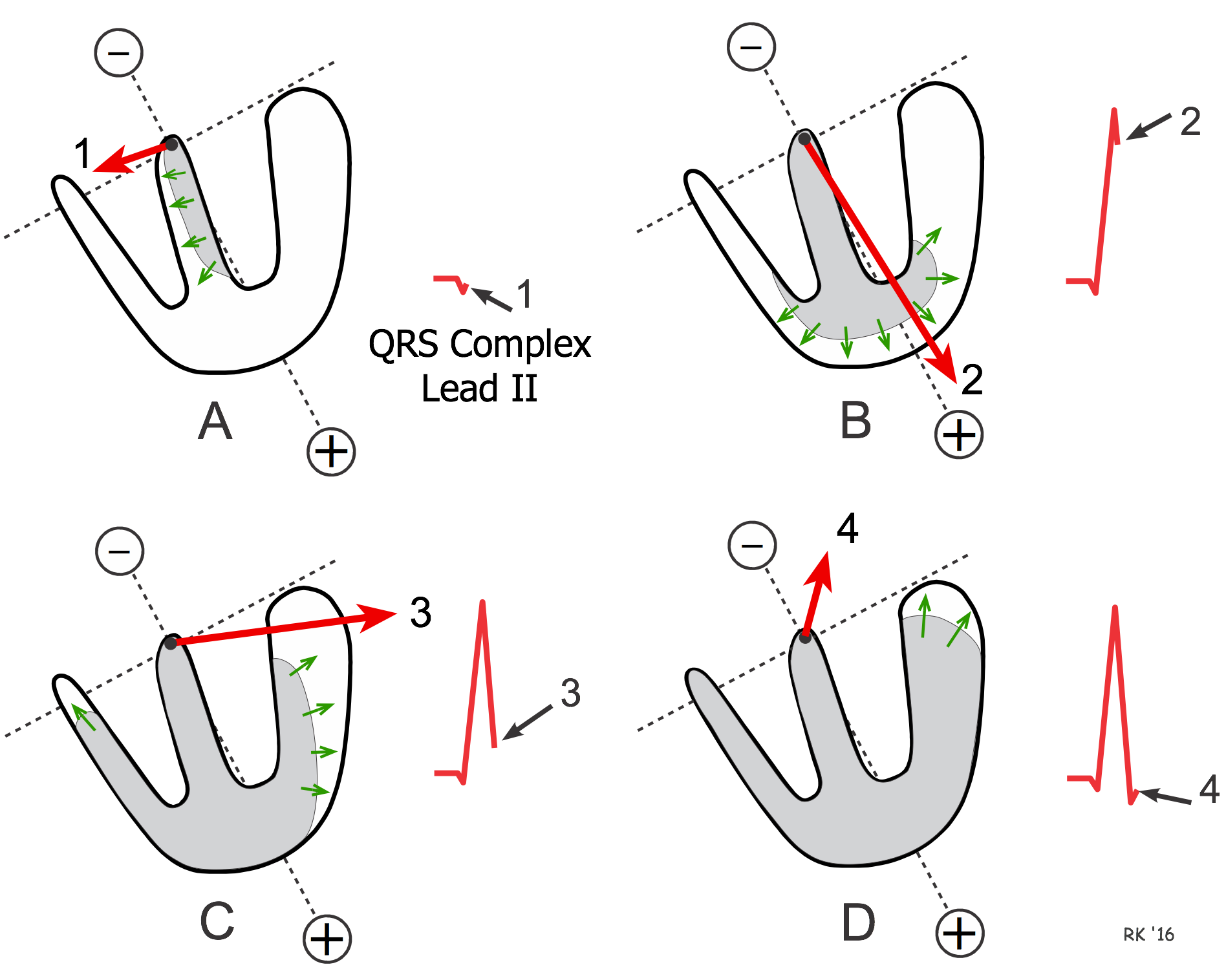 CV Physiology | Ventricular Depolarization And The Mean Electrical Axis